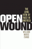 Open_wound